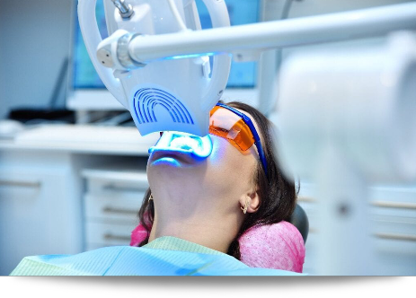 Zahnbleaching laservision garbsen